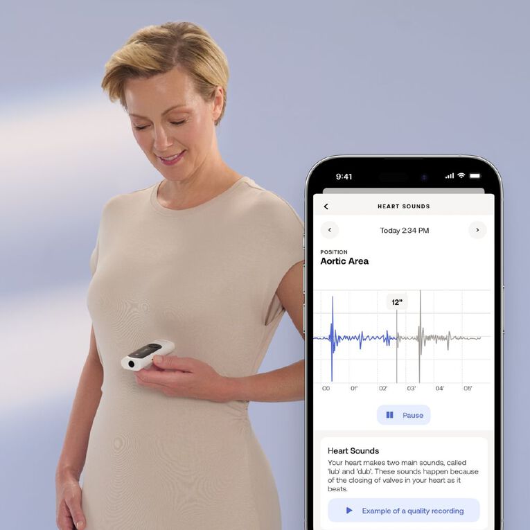 Withings BeamO 4-in-1 Multiscan Device, , hi-res